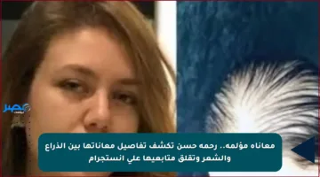 معاناة مؤلمة.. رحمة حسن تكشف تفاصيل معاناتها بين الذراع والشعر وتقلق متابعيها على إنستجرام